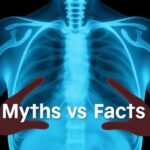 Mesothelioma Myths vs. Facts: What People Get Wrong