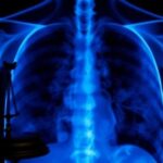 Understanding Mesothelioma Lawsuits in the USA: What Patients Should Know