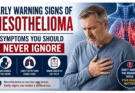 Early Warning Signs of Mesothelioma: Symptoms You Should Never Ignore