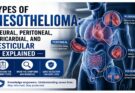 Types of Mesothelioma: Pleural, Peritoneal, Pericardial, and Testicular